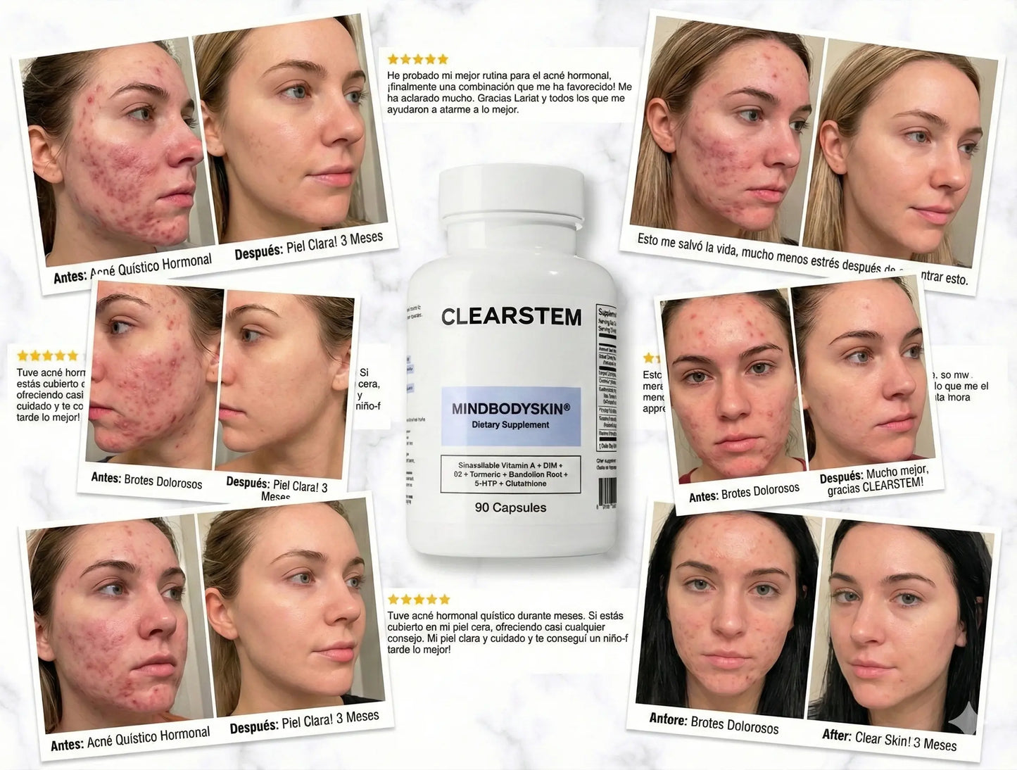 MINDBODYSKIN®  (Recupera la confianza en tu piel desde el interior)