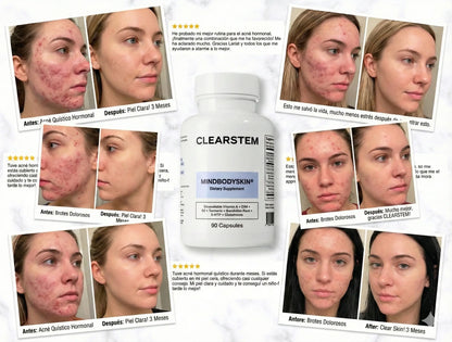 MINDBODYSKIN®  (Recupera la confianza en tu piel desde el interior)