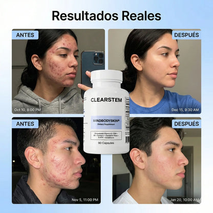 MINDBODYSKIN®  (Recupera la confianza en tu piel desde el interior)
